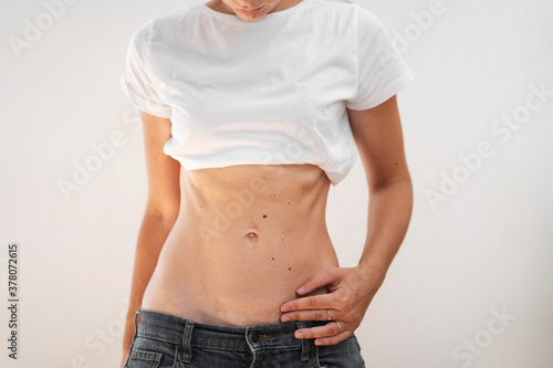 Fit sporty woman with abs and c-section scar. Postpartum recovery