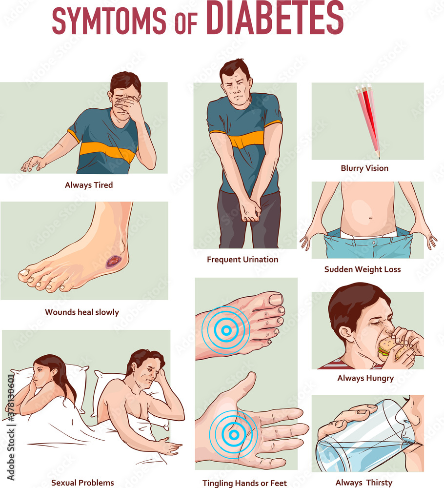 Vector illustration of a Symptoms of Diabetes infographic diagram vector de Stock Adobe Stock