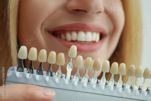 Woman matching teeth color with palette, closeup. Cosmetic dentistry