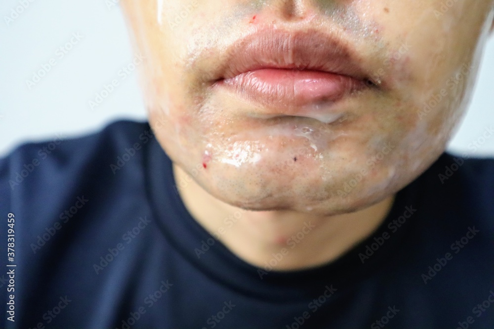 Obraz premium 髭剃り後にスキンケアをする男性のクローズアップ