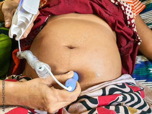 Fototapeta listening to fetal heart sound on a pregnant woman belly by a fetal doppler mach
