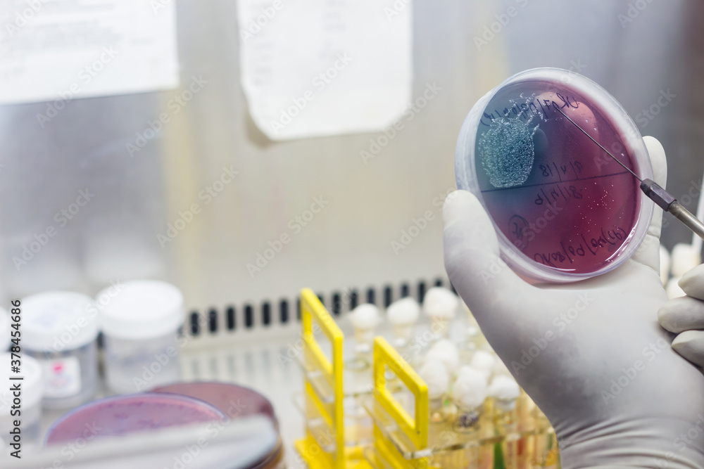 Foto de Inoculation on blood agar on a culture plate using inoculation