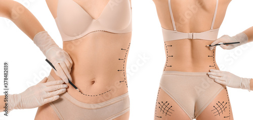 Plastic surgeon applying ma...