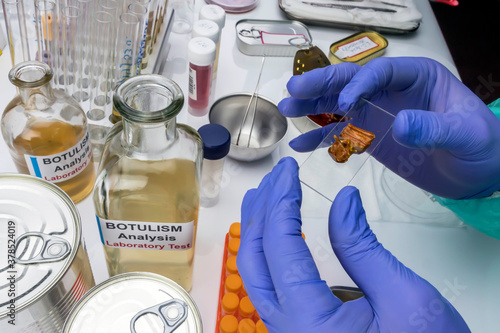 Schilderij op canvas Experienced laboratory scientist analyzing a sample from a canned food can, botu