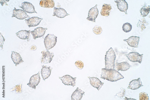 Tintinnid, any protozoan of the ciliate order Tintinnida, characteristically conical or trumpet-shaped. photo