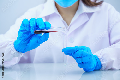 Scientist analyzing a blood sample in test tube