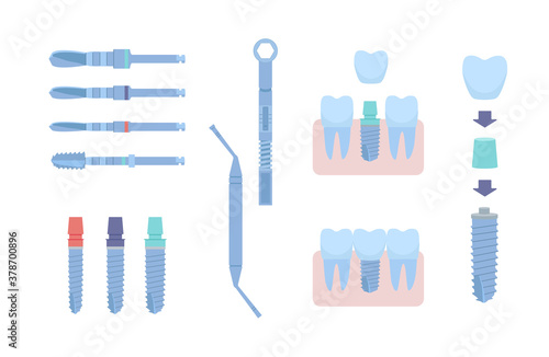 Dental tools for dental implants. Medical metal and titanium. Vector illustration, in a flat style. Poster to the clinic, image for instructions for dentists, training books. Isolated on white.