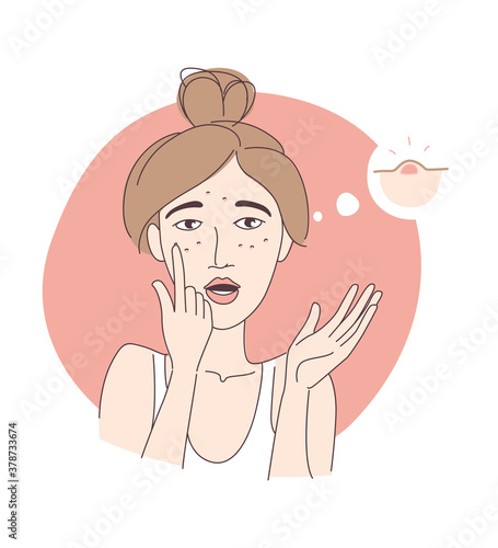 Teenage girl noticed her pimples on her face.