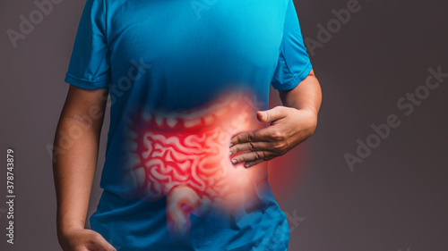 Irritable Bowel Syndrome (IBS)., x-ray concept. photo