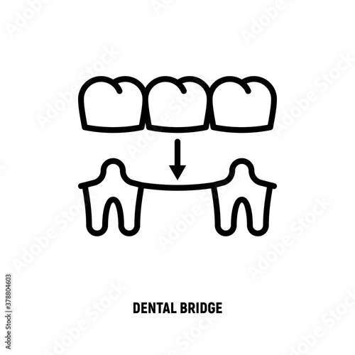 Dental bridge thin line icon. Dentistry, prosthesis. Tooth restoration. Vector illustration.