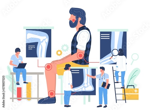 Elbow, knee and ankle arthritis. Man patient suffering from joint pain, flat vector illustration. Tiny doctors examining xray pictures of joints in doctor office. Osteoarthritis, rheumatoid arthritis.
