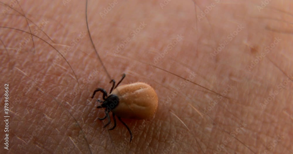 Closeup of a tick. A small mite sucking the blood of mammals on human skin. Closeup of a tick. A small mite sucking the blood of mammals on human skin.