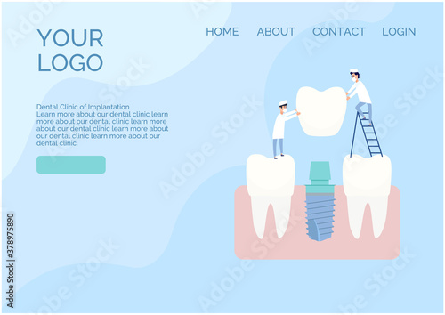 Vector website design in a flat style. Two implantologist doctors install a dental implant: put a crown on the abutment. Healthy teeth nearby. Blue and white colors, cartoon style clip art.