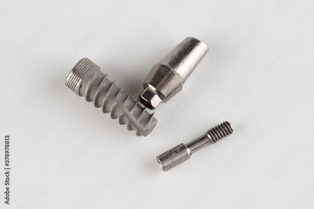 dental titanium implant with locking elements dental titanium implant with locking elements