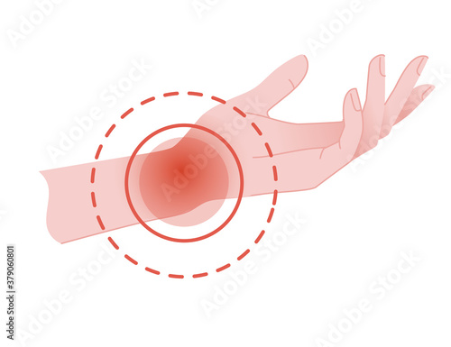 Human wrist pain with red pain circle flat vector illustration on white background