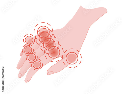 Human pain in the fingers with red pain circle flat vector illustration on white background