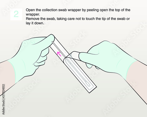 Open the collection swab wrapper by peeling open the top of the wrapper. Remove the swab, taking care not to touch the tip of the swab or lay it down. Step 2