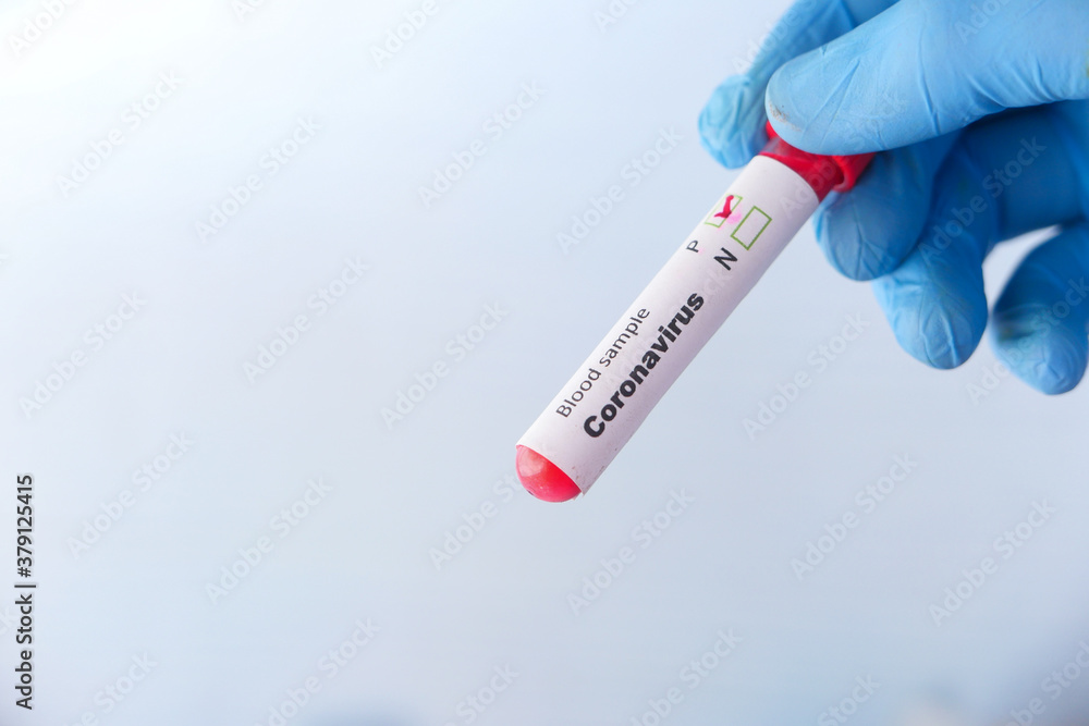 Naklejka premium laboratory technician hand holding blood test tube