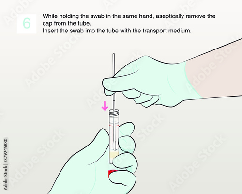 While holding the swab in the same hand, aseptically remove the cap from the tube. Insert the swab into the tube with the transport medium. Step 6