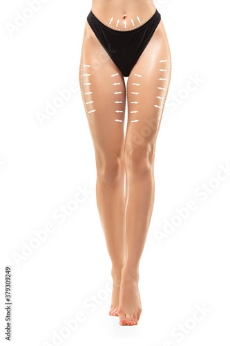 Cellulite removal plan. The black markings on young woman body preparing for plastic surgery. Concept of body correction, beauty, surgery procedure, liposuction. Fit female body. Copyspace.