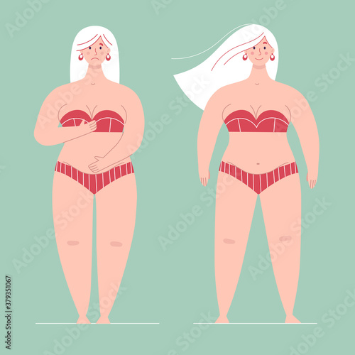 A beautiful plump woman in a swimsuit stands in full growth.One is ashamed of her body, the other is happy and loves hers.Concept of body positive,self love, overweight.Flat vector female character