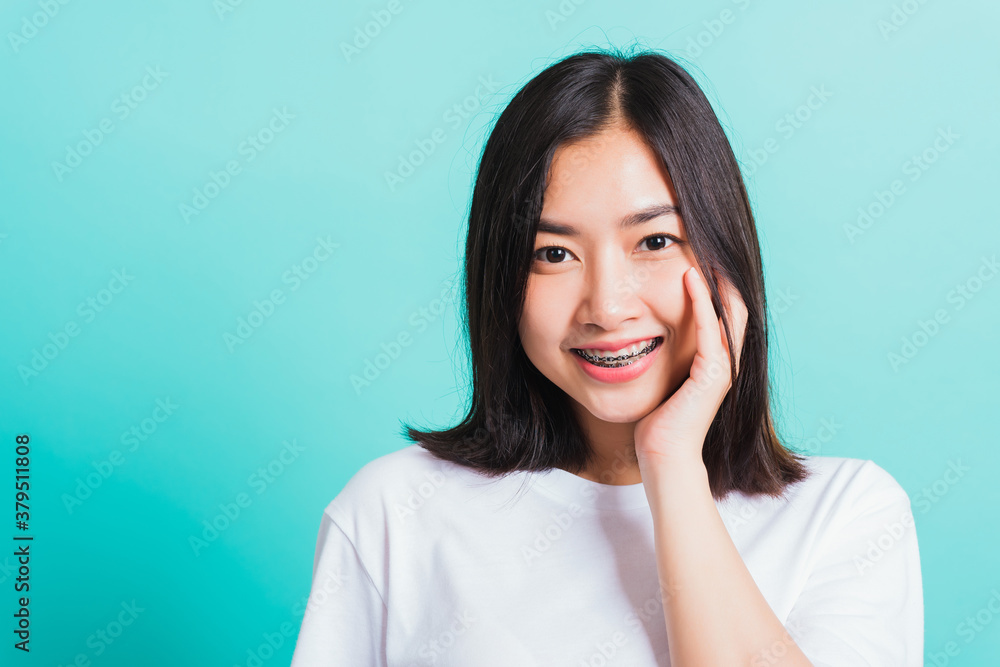 Portrait of Asian teen beautiful young woman smile have dental braces on teeth laughing she touching her face by hand, studio shot isolated on a blue background, Medicine and dentistry concept Portrait of Asian teen beautiful young woman smile have dental braces on teeth laughing she touching her face by hand, studio shot isolated on a blue background, Medicine and dentistry concept