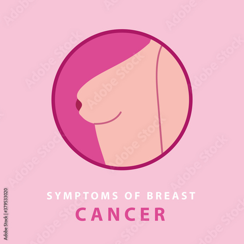 symptoms of breast cancer, nipple turning inward
