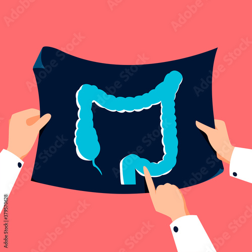Doctor holding colon xray vector illustration. Medical checkup banner in flat cartoon style. Healthcare background.