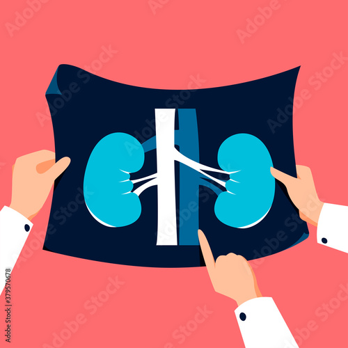 Doctor holding kidney xray vector illustration. Medical checkup banner in flat cartoon style.. Healthcare background.