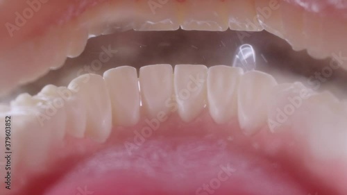 Water flosser cleaning teeth on black background. View inside of mouth, open jaw. Teeth cleaning with oral irrigator. 4k 120 fps photo