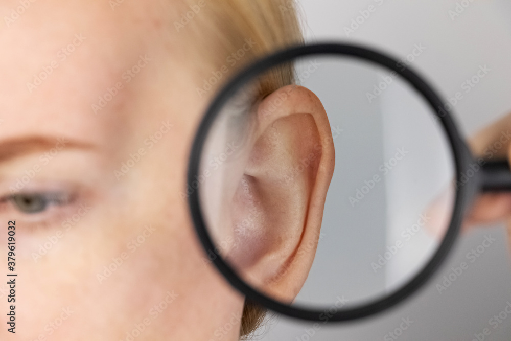 Darwin's tubercle on the ear. The girl at the reception at the plastic