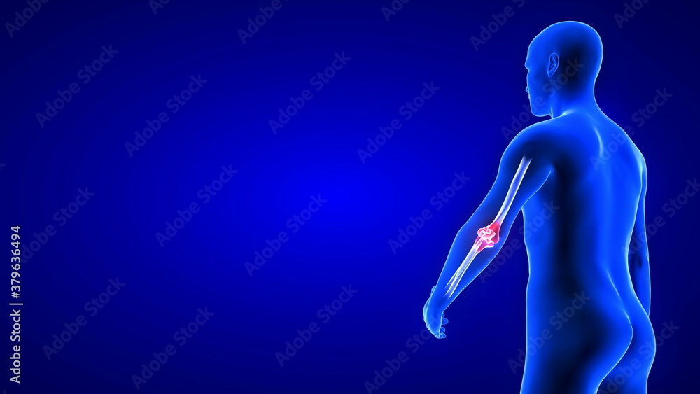 Elbow Pain illustration from rear view - close-up. Blue Human Anatomy Body 3D Scan render - blue background Elbow Pain illustration from rear view - close-up. Blue Human Anatomy Body 3D Scan render - blue background