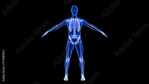 Elbow Pain. Blue Human Anatomy Body 3D Scan render on black background © m3ron