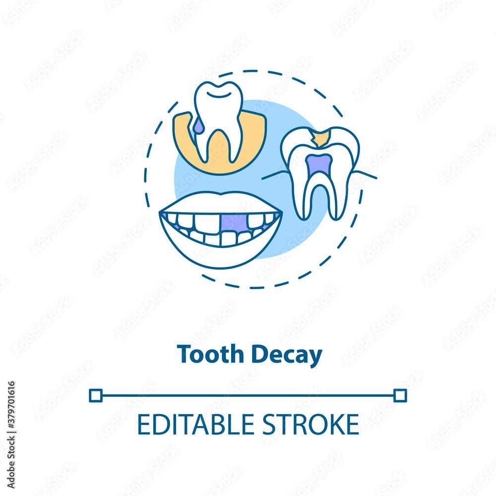 Tooth decay concept icon. Energy drinks negative side effects idea thin line illustration. Tooth breakage and loss. Dental erosion. Vector isolated outline RGB color drawing. Editable stroke Tooth decay concept icon. Energy drinks negative side effects idea thin line illustration. Tooth breakage and loss. Dental erosion. Vector isolated outline RGB color drawing. Editable stroke