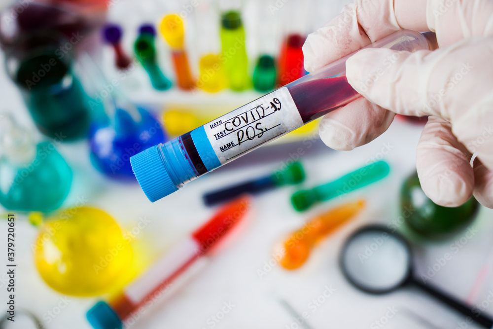 Corona virus, Covid - 19 positive blood test tube in laboratory Corona virus, Covid - 19 positive blood test tube in laboratory