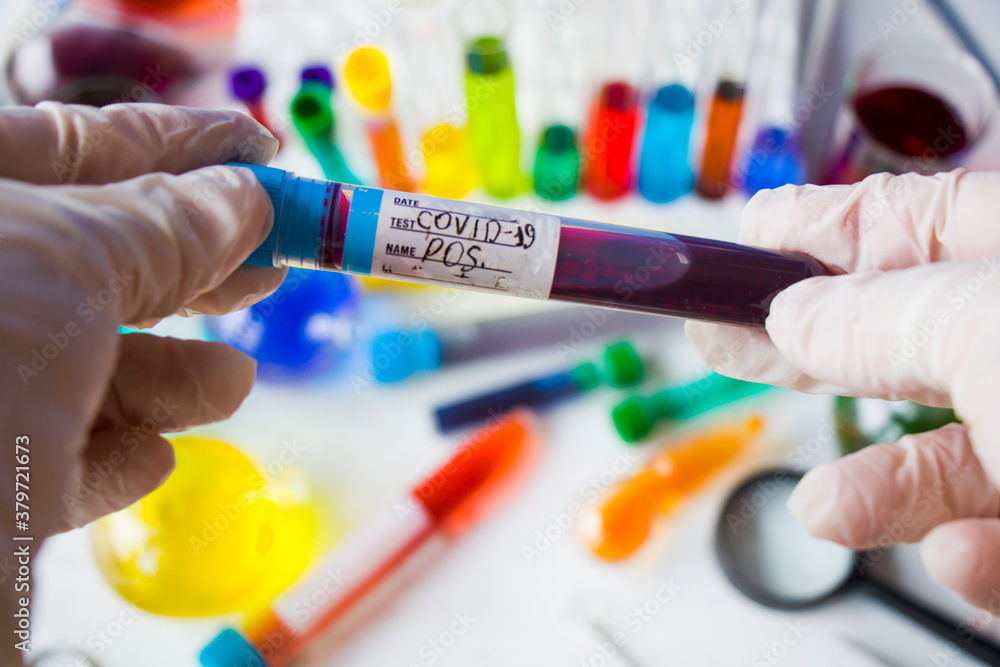 Corona virus, Covid - 19 positive blood test tube in laboratory Corona virus, Covid - 19 positive blood test tube in laboratory