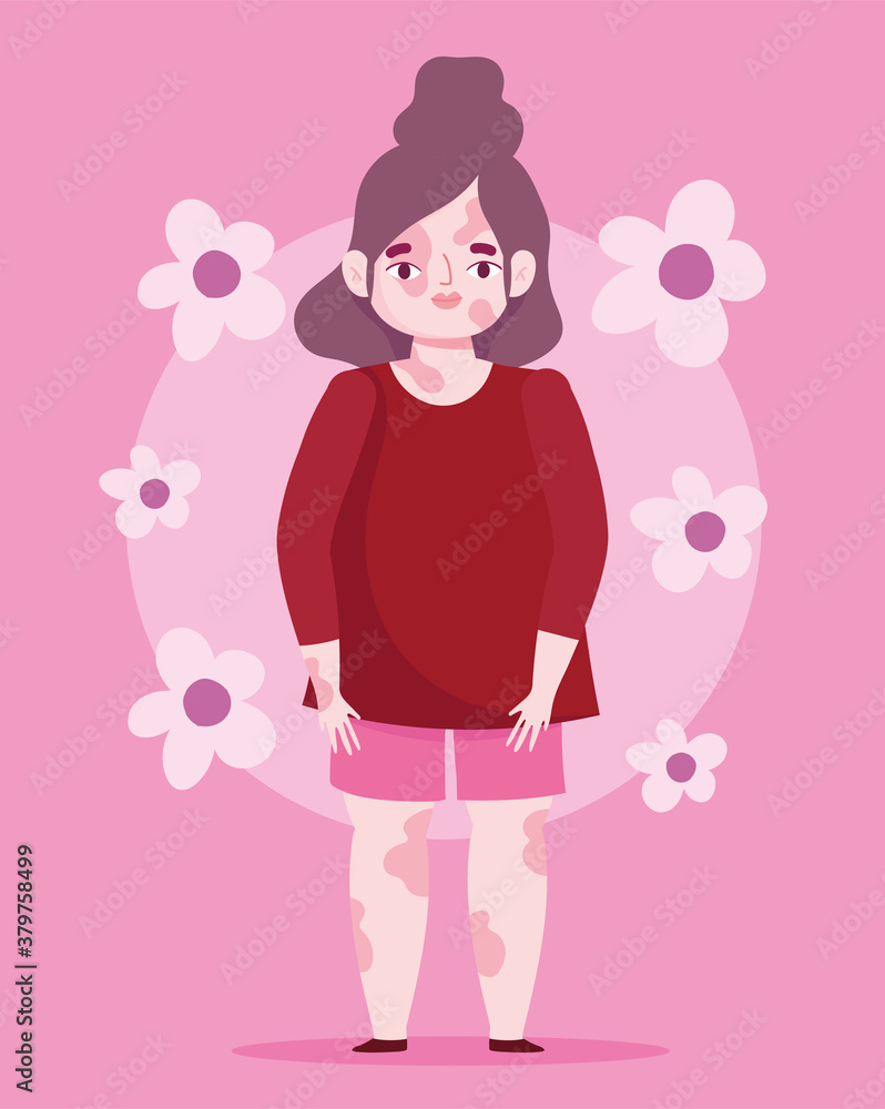 perfectly imperfect, cartoon beautiful woman with problem skin vitiligo, flowers pink background perfectly imperfect, cartoon beautiful woman with problem skin vitiligo, flowers pink background