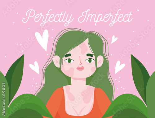 perfectly imperfect, cartoon woman with pigmentation disease