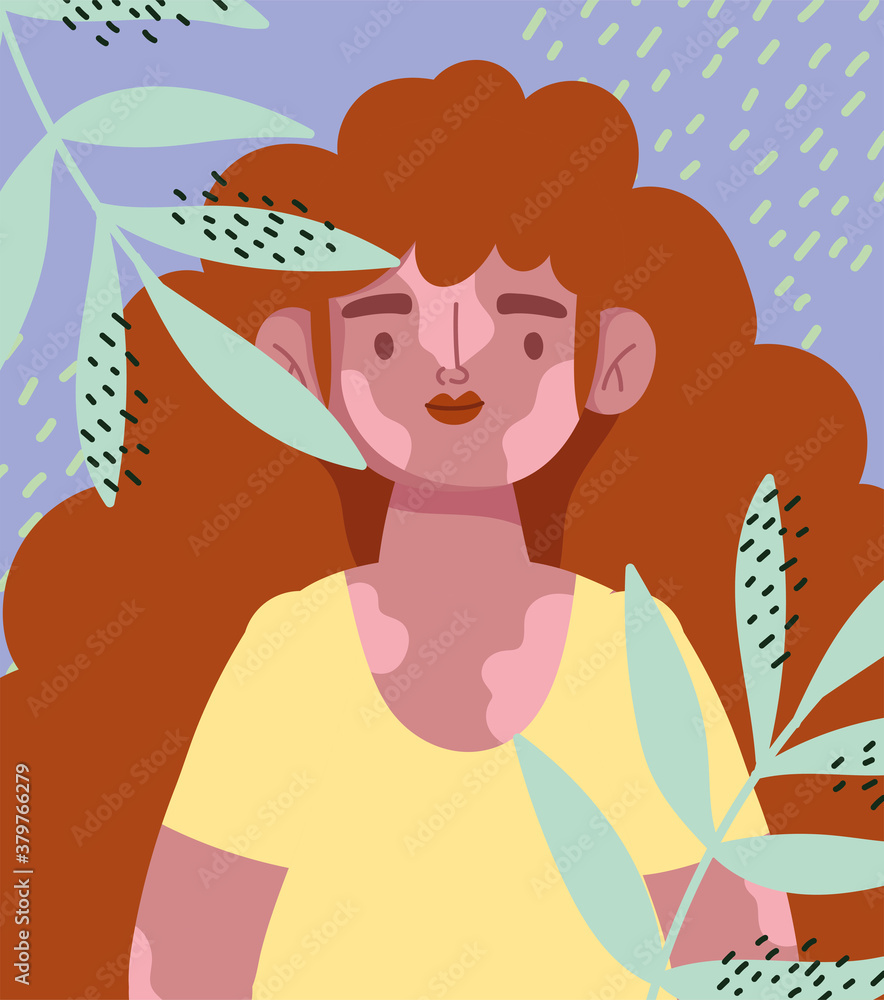 Fototapeta premium perfectly imperfect, cartoon girl curly hair and vitiligo, leaves decoration card