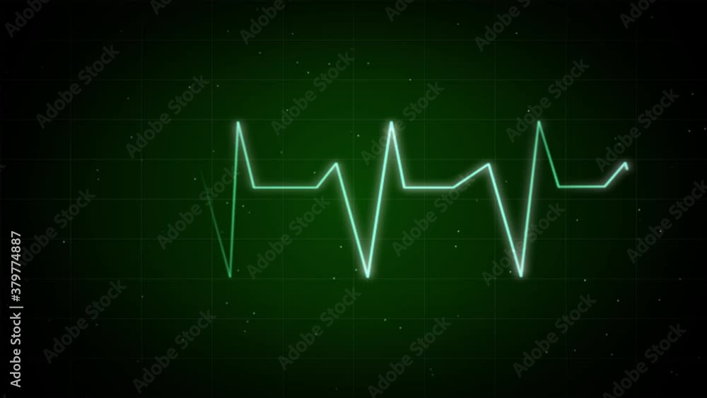 Graph of Heart Rhythm Heartbeat monitor EKG line monitor Loop Background 4K. shows heartthrob electrocardiogram medical screen with a graph of heart rhythm on black background Graph of Heart Rhythm Heartbeat monitor EKG line monitor Loop Background 4K. shows heartthrob electrocardiogram medical screen with a graph of heart rhythm on black background