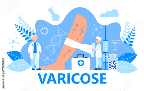 Varicose veins concept vector for medical website. Tiny surgeons, therapists treat vascular diseases, apply tight bandage.