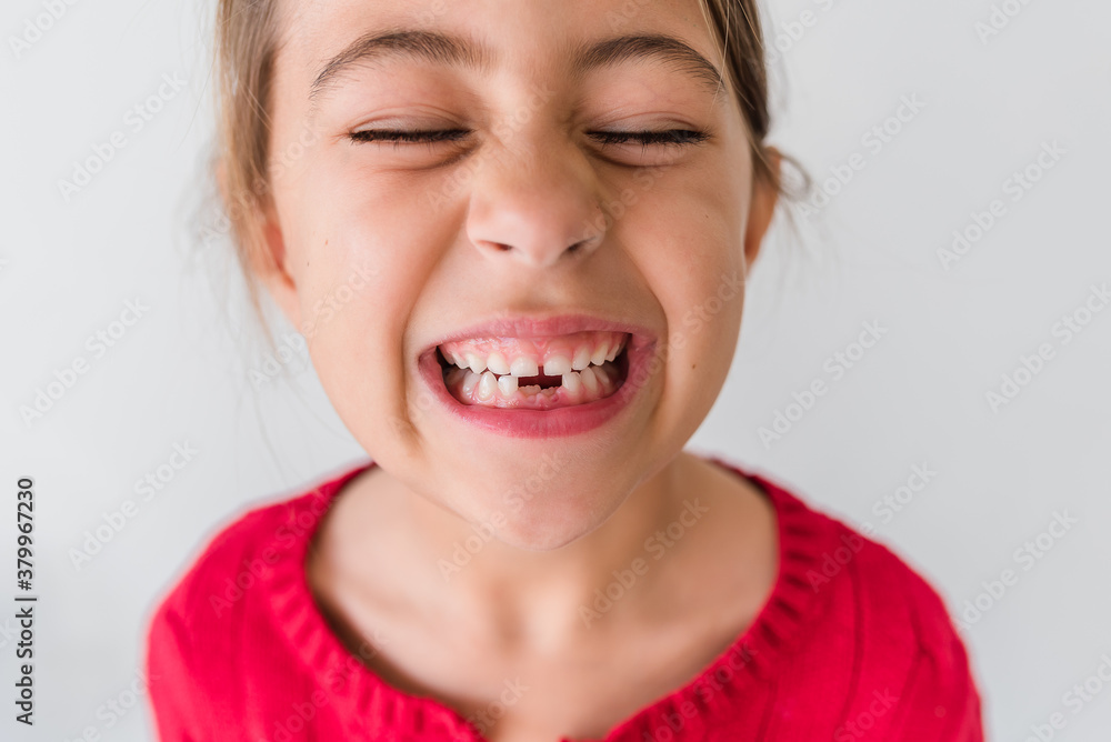 Smiling Girl Showing Her Missing Teeth Smiling Girl Showing Her Missing Teeth