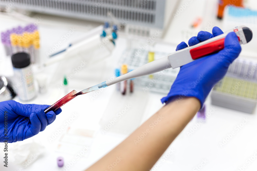 Blood samples being tested in a lab Blood samples being tested in a lab