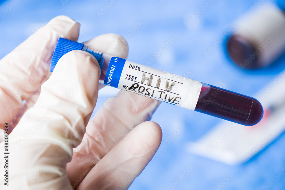 Fototapeta premium Hiv and aids infection test, hand holding tube with blood on the blue background.