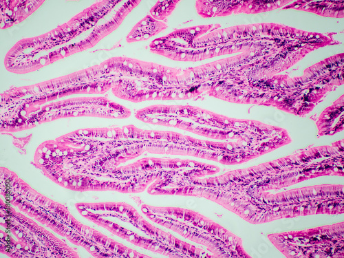 intestinal tract tissue of zebra fish micrograph photo