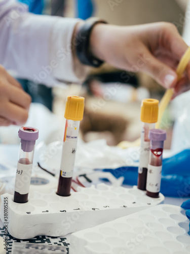 medical blood test tubes photo