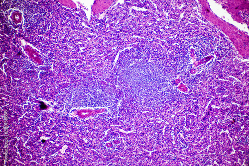 Central antery hyaline degene of human spleen photo