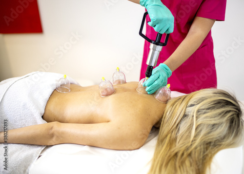 View of a young woman getting a  ventosa massage in a spa salon photo