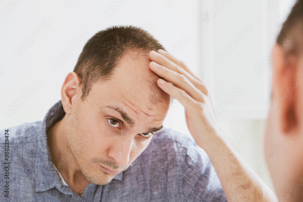 Fototapeta premium Young man looking at mirror worry about balding.