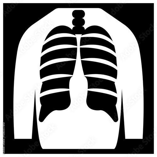 X.Ray